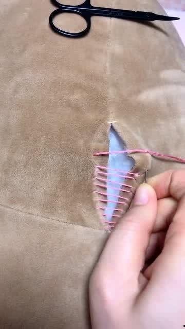 网红隐形针法,美容新潮流还是风险隐患？